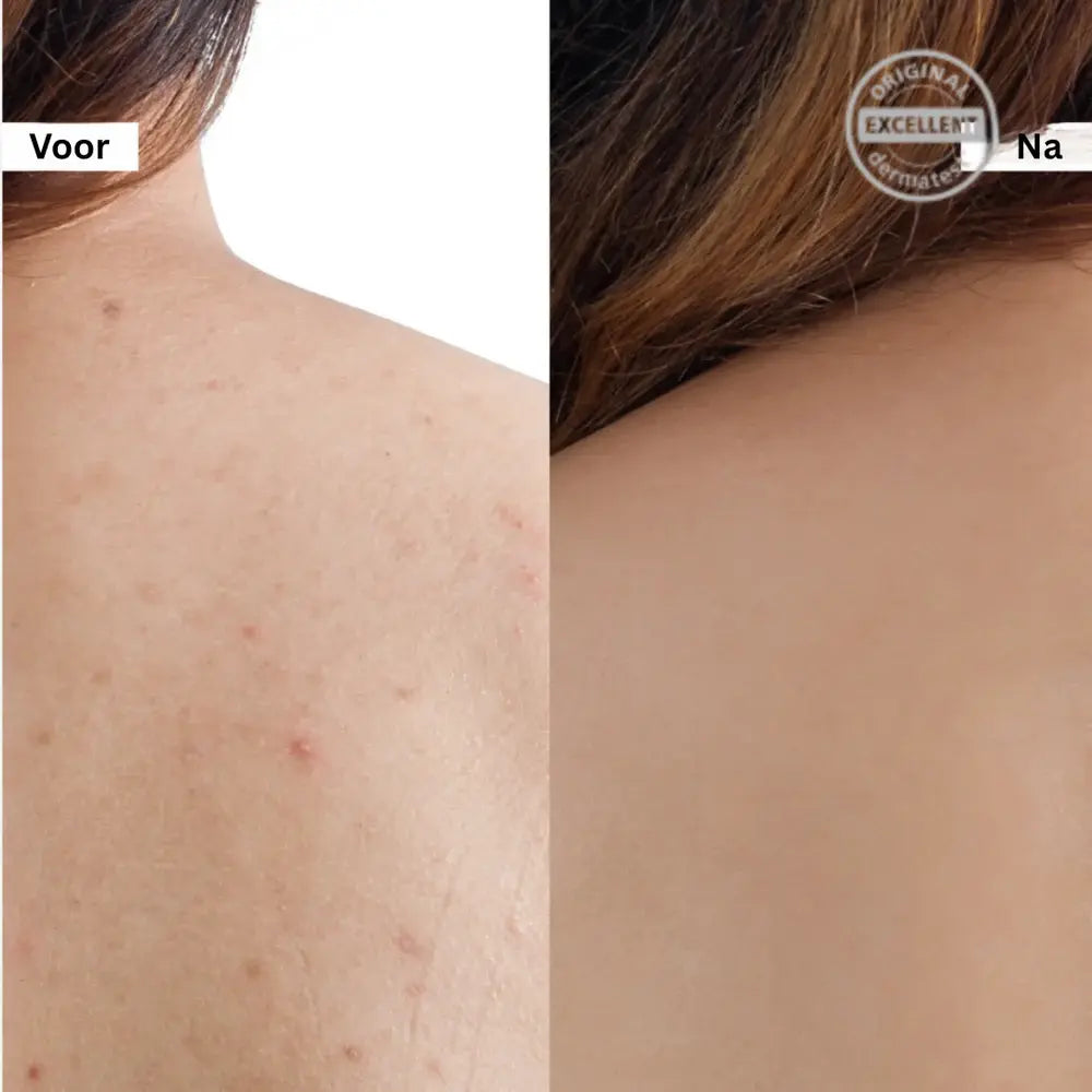 Crema Facial Reafirmante de Poros con Sal Rosa